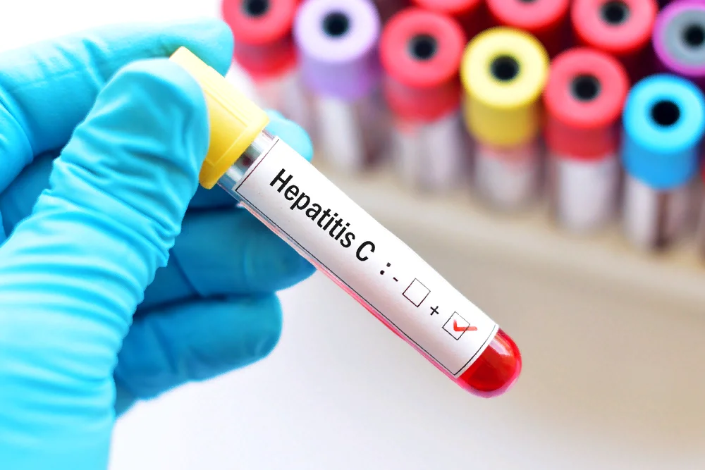 Что делать при повторном обнаружении гепатита C